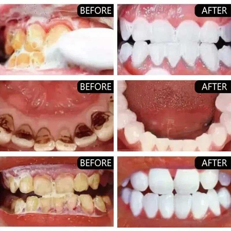 Pasta de dientes para eliminar - Teeth Whitening Fast reseña y precio