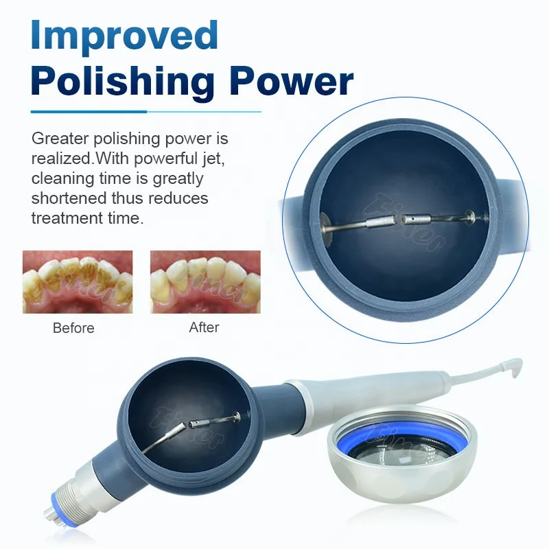 Prophy Mate Limpieza de diente - Teeth Whitening Fast reseña y precio